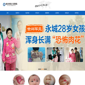 商丘邓主任胎记血管瘤