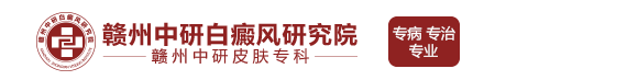 赣州白癜风医院